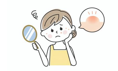にきび