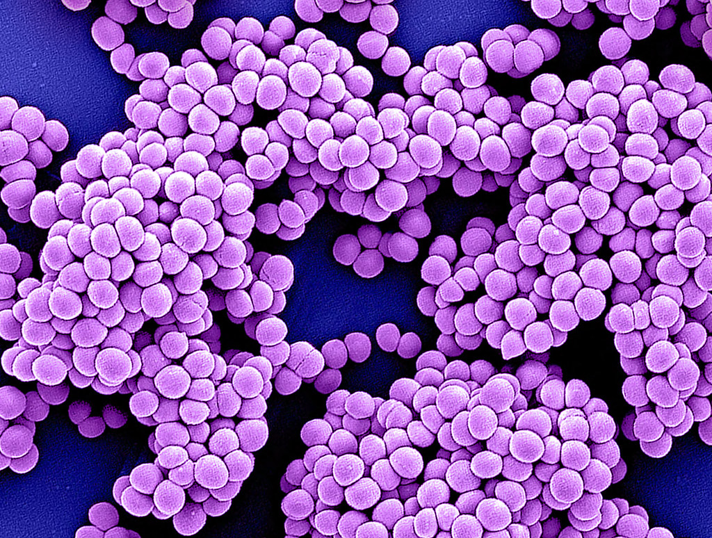 MRSA