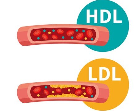 HDL（善玉）と LDL（悪玉）