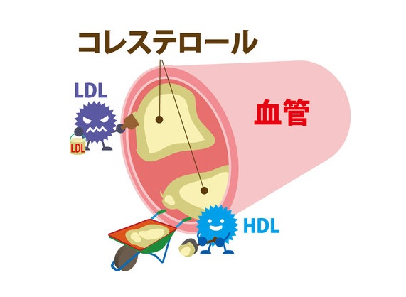 コレステロール